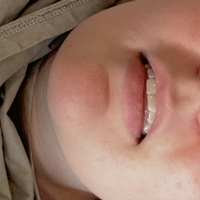 Аллиридсхсмут Голая